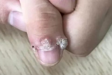 手指头